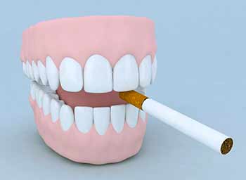 Kvindelige rygere har større risiko for at miste tænder efter overgangsalderen end mandlige rygere på samme alder.
